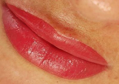 SPMU - Lips - Treatment
