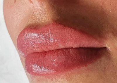 SPMU - Lips - treatment