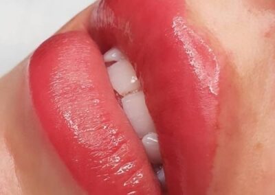 SPMU - lips - treatment