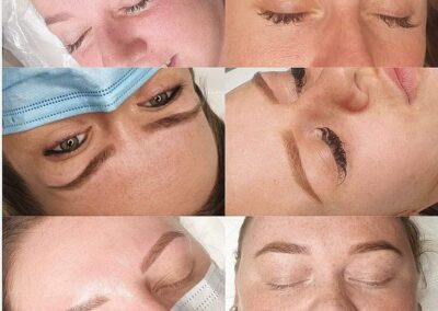 SPMU - healed eyebrows - treatment