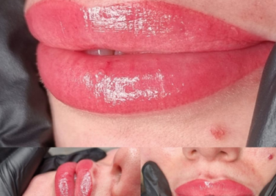 SPMU - lip tattoo - beauty treatment