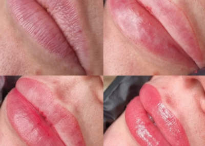 SPMU lips - before and after - beauty treatments